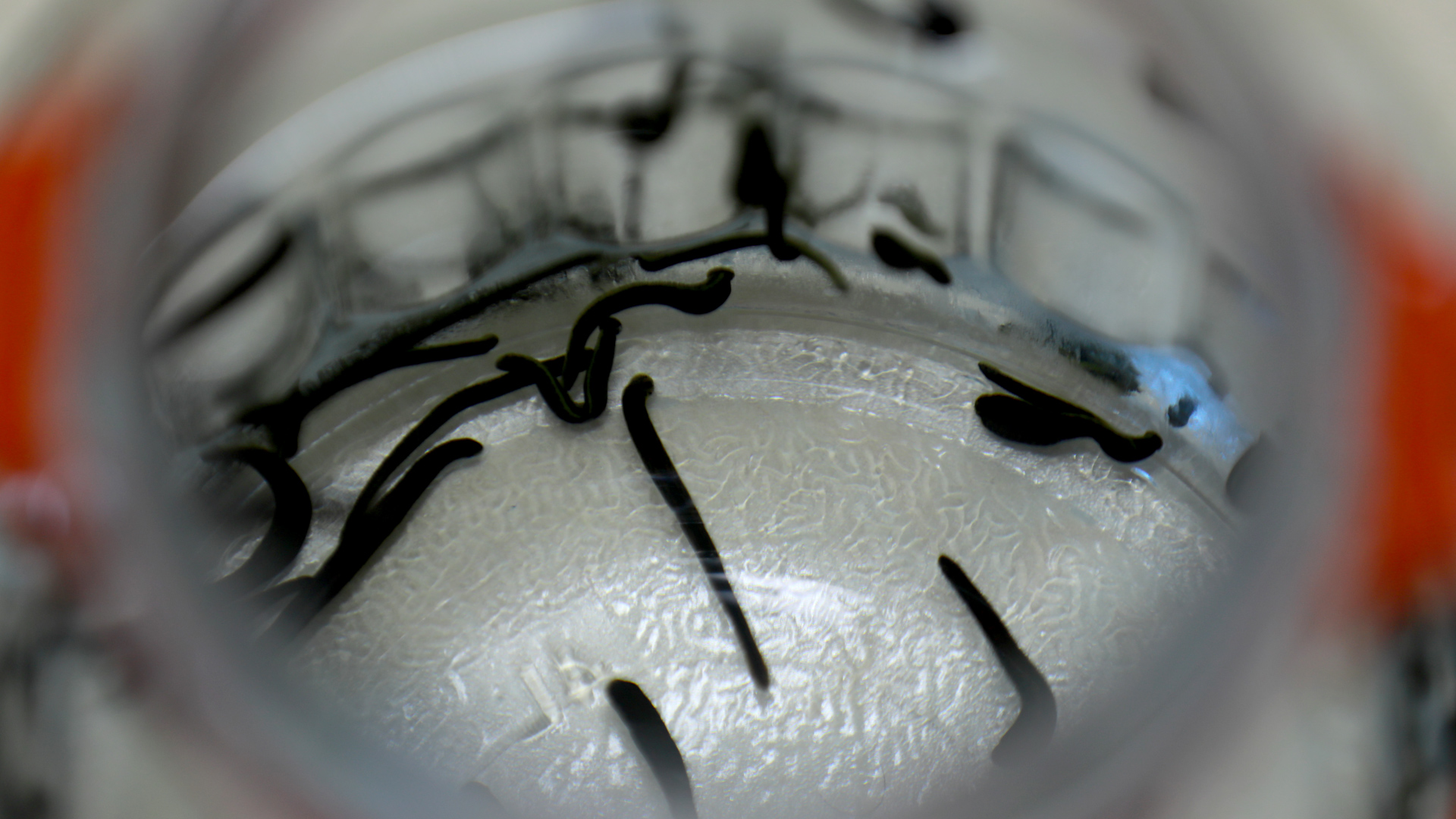 Hacamat, sülük, akupunktur... Bakanlık bünyesinde enstitü kuruldu, geleneksel tıp geliştirilecek